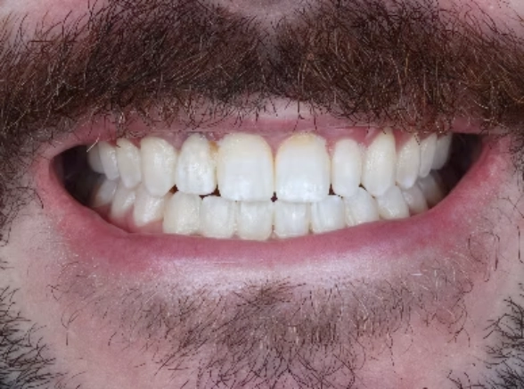 Smile before treatment