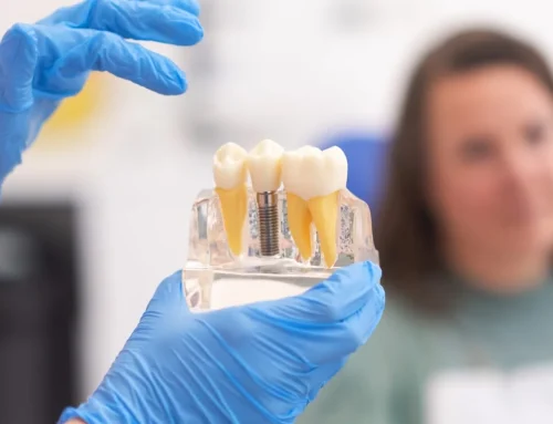 Dental Implant Costs Explained: What Actually Drives the Price