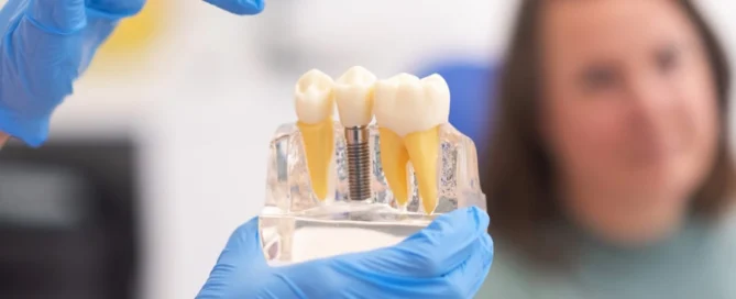 Implant Dentistry in New York
